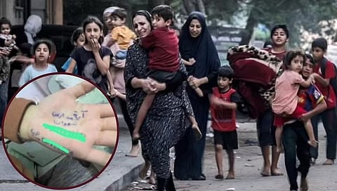 Israel–Hamas war : भय इथले संपत नाही! मृत्यूनंतर ओळख पटण्यासाठी पॅलेस्टिनी चिमुरडे हातावर लिहितात नाव