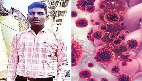 ट्यूमरमुळे उंची झाली 7 फूट 2 इंच!