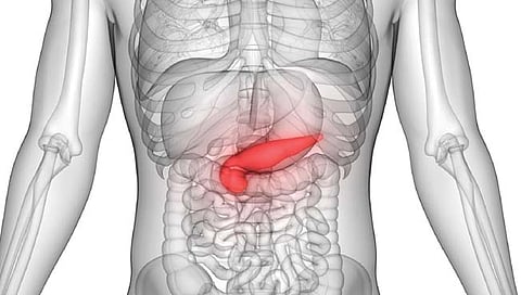 स्वादुपिंडावरील सूज कशामुळे? जाणून घ्या लक्षणे आणि उपचार