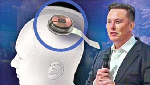 human brain chip : मानवी मेंदूत चीप बसवण्याच्या प्रयोगाला अमेरिकेत मंजुरी