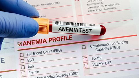 Anemia in children