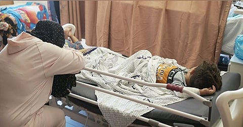 गाझा शहरातील अल-शिफा रुग्णालयात लाइफ सपोर्टवर अनेक जखमी बालकांना ठेवण्यात आले आहे.