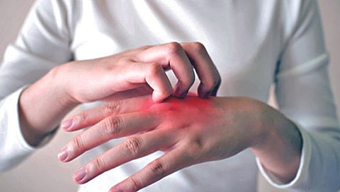 Diabetes and Skin Problems : मधुमेह आणि त्वचेच्या समस्या, जाणून घ्या सविस्तर