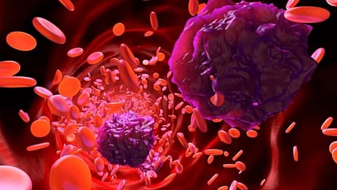 Cancer : कॅन्सरवर आता पावडर स्वरूपात औषध; मुंबईतील टाटा हॉस्पिटलच्या डॉक्टरांची कामगिरी