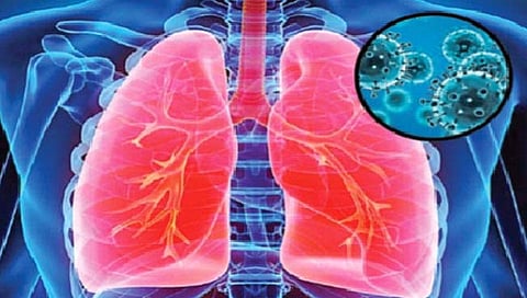 कोरोनाने अनेक भारतीयांना दिले फुप्फुसाचे दुखणे!