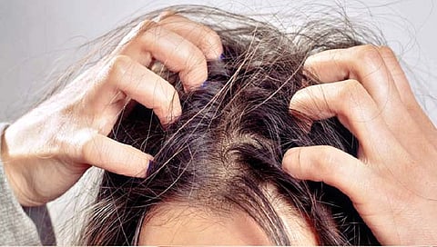 वारंवार डोकं खाजवताय? जाणून घ्या कारणे