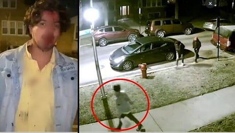 Chicago student attacked : शिकागोमध्ये आणखी एका भारतीय विद्यार्थ्यावर अमानुष हल्ला