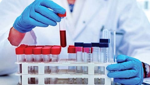 कोल्हापूर : ठिकपुर्लीत कावीळचे 45 रुग्ण; 120 रुग्णांचे रक्त नमुने घेतले