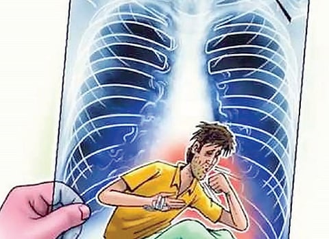 सकारात्मक बातमी : राज्यात क्षयरोग रुग्णांच्या नोंदणीत घट