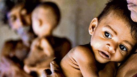 राज्यात शहरी भागालाही कुपोषणाची बाधा, ग्राम बाल विकास केंद्राच्या धर्तीवर आता शहरात सुरू करणार ‘नागरी बाल विकास केंद्रे’