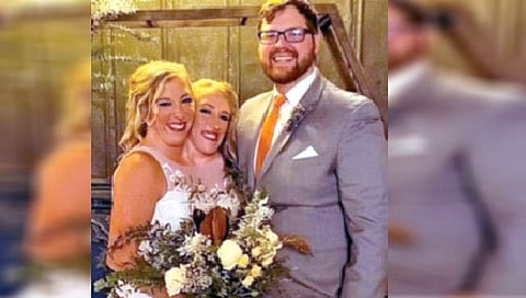 सयामी जुळ्या बहिणींनी केले लग्न