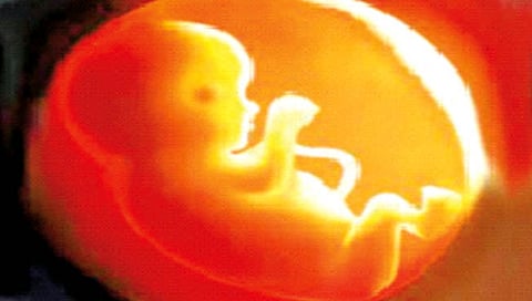 धक्कादायक ! : आईच्या गर्भातच उमलणार्या कळ्या खुडण्याचे महापाप; गोठ्यात गर्भलिंग चाचणीचा गोरखधंदा, पोलिसांकडून पर्दाफाश