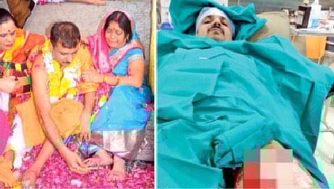 आईसाठी स्वतःच्या कातड्यापासून बनवली चप्पल