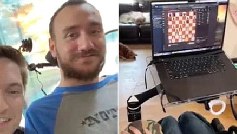 लकवाग्रस्त व्यक्ती न्यूरालिंक ब्रेन चिपने खेळली बुद्धिबळ