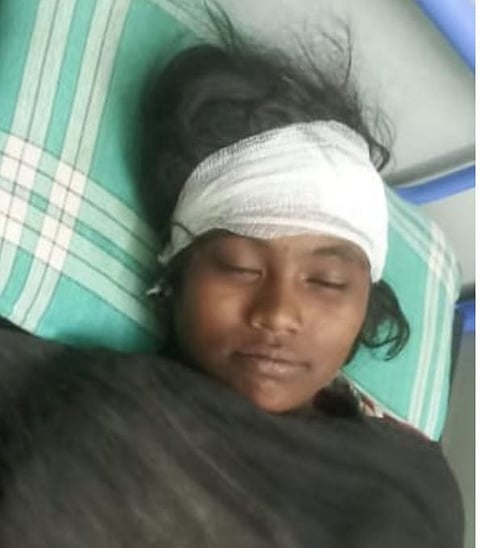 Leopard attack : पिंपळवंडी येथे बिबट्याच्या हल्ल्यात तरूणी जखमी