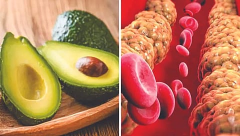 Bad Cholesterol : वाईट कोलेस्टेरॉल कमी करण्यासाठी ‘हे’ फळ गुणकारी