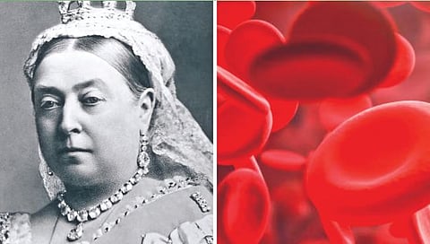 व्हिक्टोरिया राणीला ‘हा’ होता आजार