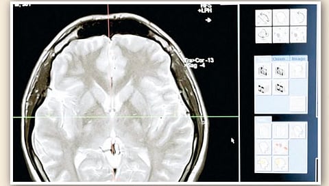 मेंदूचा आकार वाढतोय; पण ‘आयक्यू’ होतोय कमी!