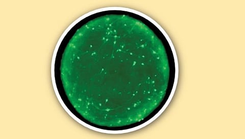 कृत्रिम मेंदूमुळे आता डिमेन्शियाबाबत नवे संशोधन शक्य