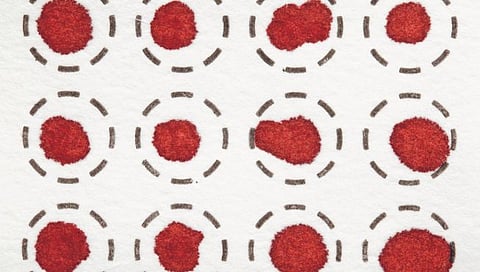 रक्ताच्या ‘एआय’ चाचणीने होणार कर्करोगाचे निदान