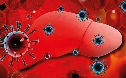 व्हायरल हिपॅटायटीस