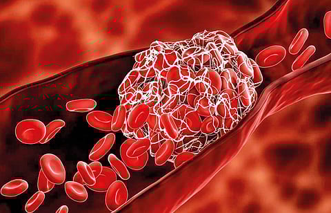 ब्लड क्लॉटिंगच्या अंतरंगात