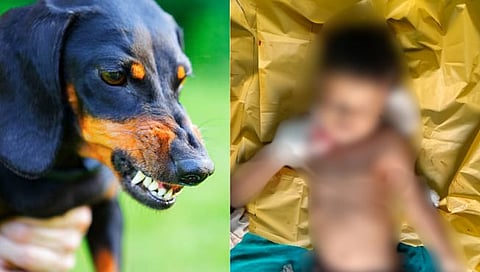 मोकाट कुत्र्यांच्य़ा हल्ल्यात बालकाचा मृत्यू