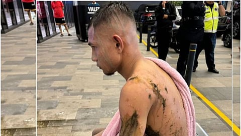 मलेशियाचा फुटबॉ़लपटू फैजल अॅसिड हल्यात जखमी झाला.