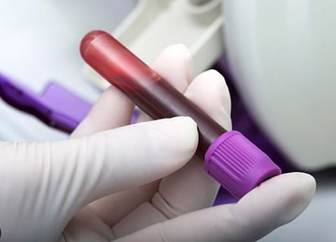 pune porsche accident : आरोपींची रक्त तपासणी होणार ‘इन कॅमेरा’