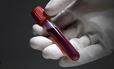 pune porsche accident : रक्ताच्या नमुन्यांमध्ये अल्कोहोल आढळलेच नाही