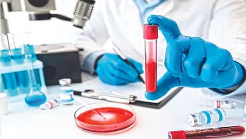 अवघ्या 10 ते 50 पैशांत होणार हिमोग्लोबिनची चाचणी