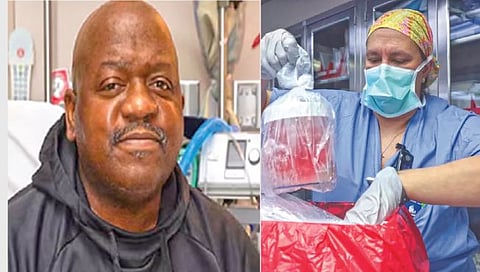 डुकराच्या किडनीवर जगणार्या ‘त्या’ व्यक्तीचा कसा झाला मृत्यू?