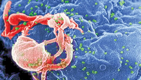 पेशीतून कात्रीसारखे कापून वेगळा करता येणार ‘एचआयव्ही’ विषाणू!