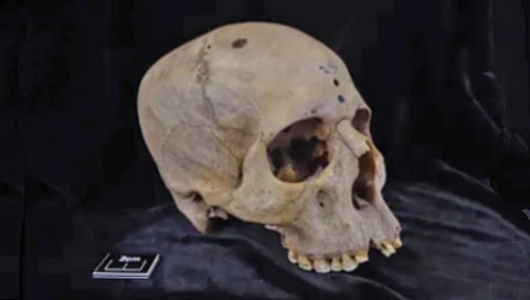 चार हजार वर्षांपूर्वी झाला होता कर्करोगावरील उपचाराचा प्रयत्न