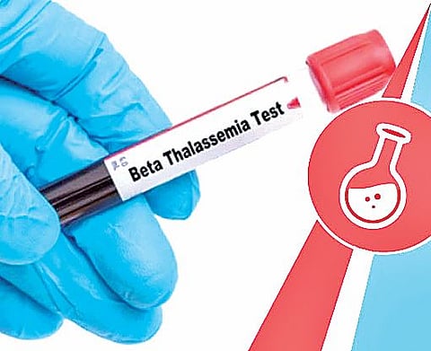 जन्मपूर्व, विवाहपूर्व तपासणी बनली आव्हानात्मक; थॅलेसेमिया रुग्णांची सर्वाधिक संख्या भारतात