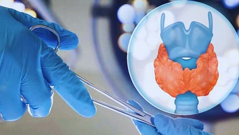 महिलेच्या मानेतून एक किलोची थायरॉईडची गाठ काढण्यात डॉक्टरांना यश