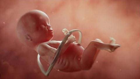 गर्भपात करणारी महिला डॉक्टर गजाआड