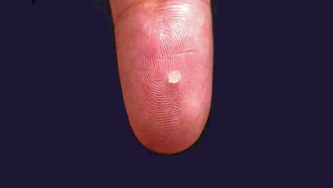 जगातील सर्वात लहान ब्रेन सेन्सर