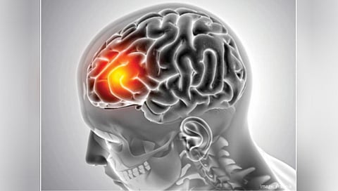 What to do to prevent brain tumors?
