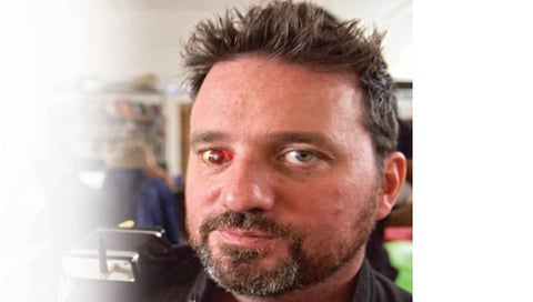 Man Places a Camera in His Eye Socket