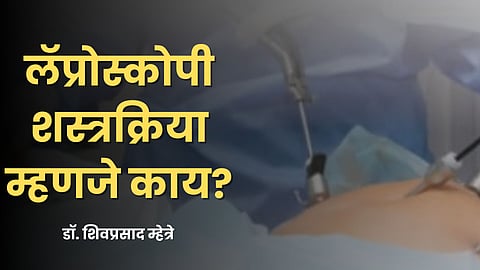 लॅप्रोस्कोपीक शस्त्रक्रिया म्हणजे काय? - डॉ. शिवप्रसाद म्हेत्रे