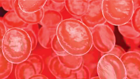 Causes and solutions for low platelets