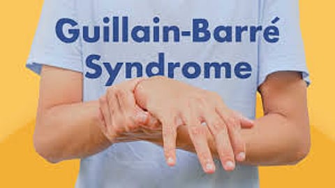 Guillain Barre Syndrome