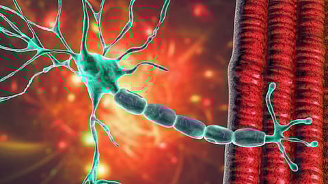 Guillain Barre Syndrome
