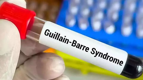 guillain barre syndrome