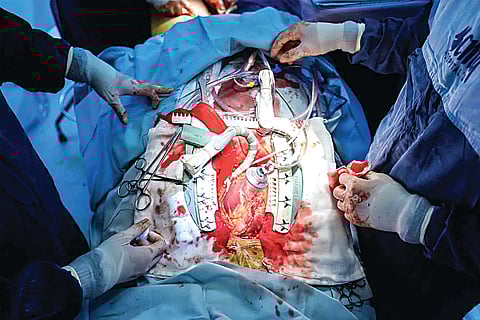 ओपन- हार्ट सर्जरी