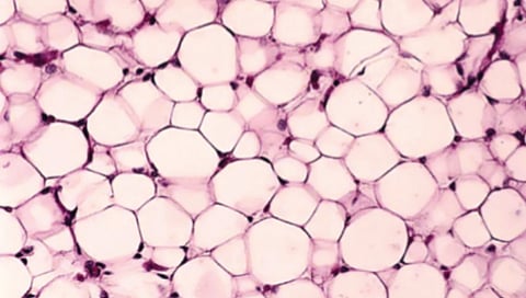 new-type-of-fat-cells-discovered-in-human-body