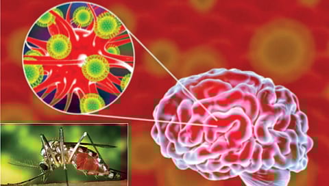 rare-brain-disease-spread-by-mosquitoes-reported-in-usa