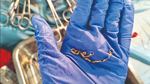 Goat cruelty for gold