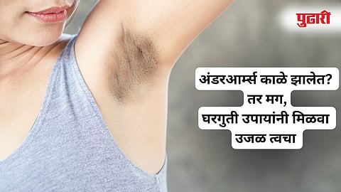 Underarm Whitening Home Remedies